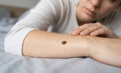 Do Bed Bugs Prefer Certain People - The Truth About Skin Chemistry and Body Heat